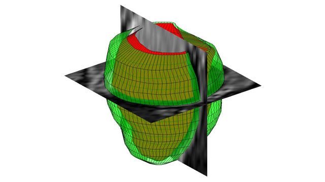 3D Image Processing – MATLAB & Simulink