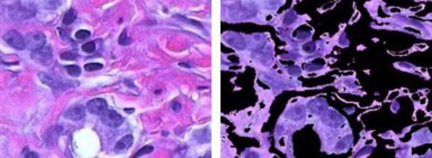 Color-based image segmentation using k-means clustering.