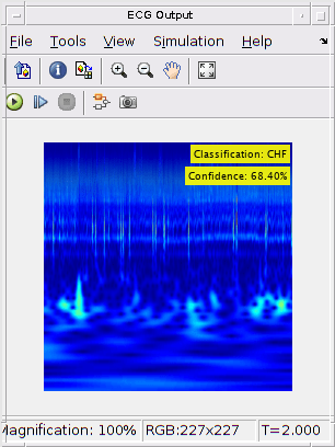 Classify ECG Signals in Simulink Using Deep Learning