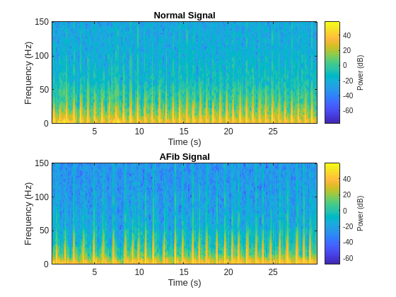 Classify ECG Signals Using Long Short-Term Memory Networks with GPU Acceleration