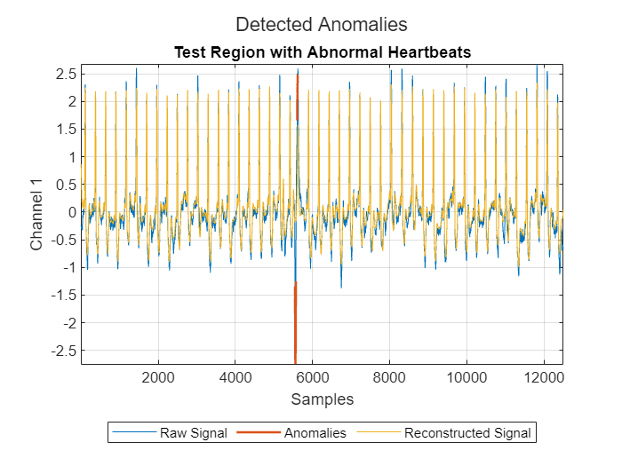 Detect Anomalies in Signals Using deepSignalAnomalyDetector