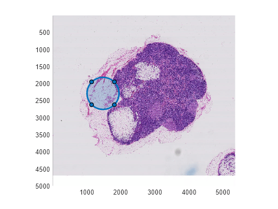 Figure contains an axes object. The axes object contains 2 objects of type bigimageshow, images.roi.circle.