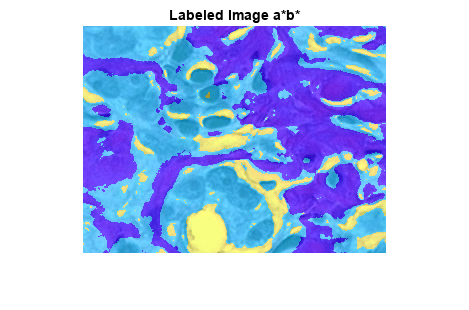 Color-Based Segmentation Using K-Means Clustering