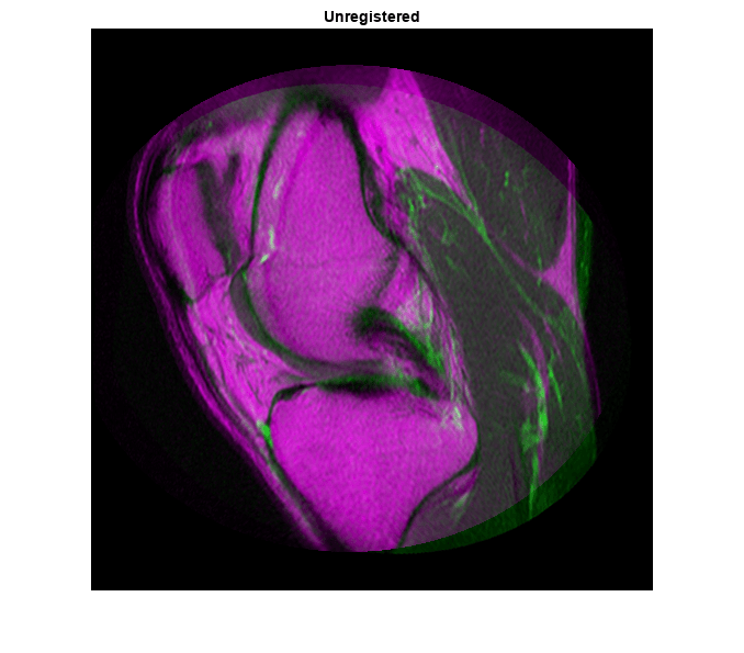 Figure contains an axes object. The axes object with title Unregistered contains an object of type image.