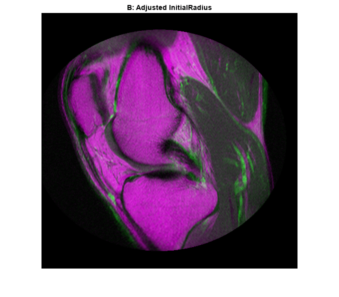 Figure contains an axes object. The axes object with title B: Adjusted InitialRadius contains an object of type image.