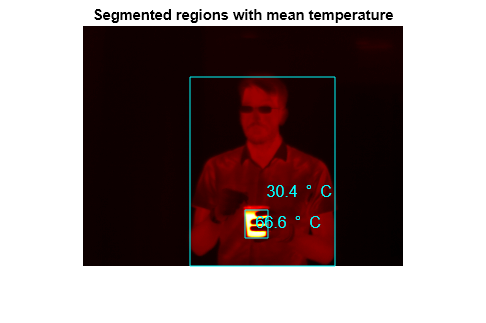 Figure contains an axes object. The hidden axes object with title Segmented regions with mean temperature contains 5 objects of type image, rectangle, text.