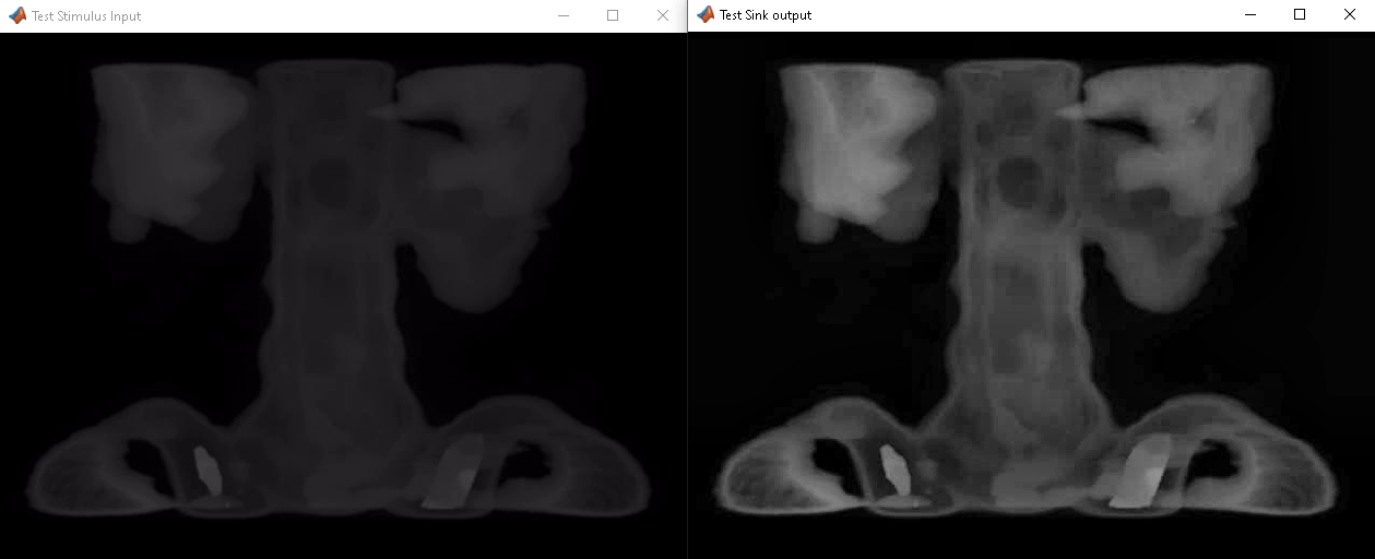 Contrast Limited Adaptive Histogram Equalization with External Memory